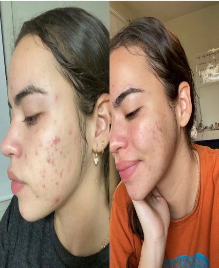 You can actually see the difference